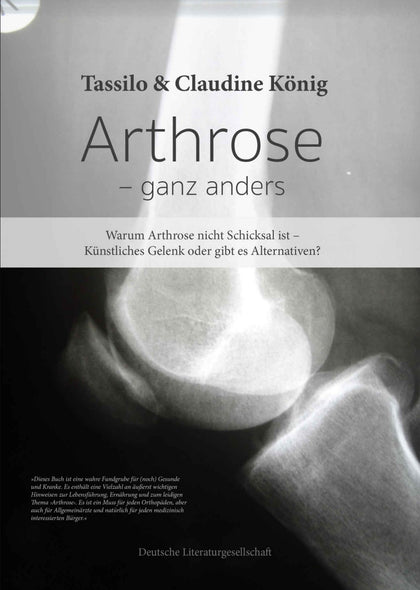 Arthrose – ganz anders.